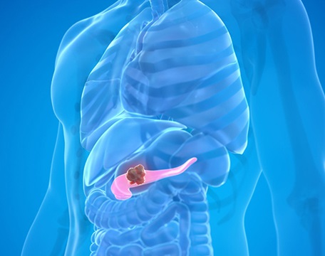 Dokter Bedah Hepatobiliari – Pankreas