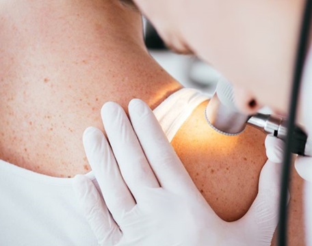 Dokter Dermatologi (Kulit)